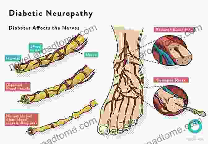 Diagram Of The Anatomy Of The Diabetic Foot Diabetic Foot The Randell Alexander