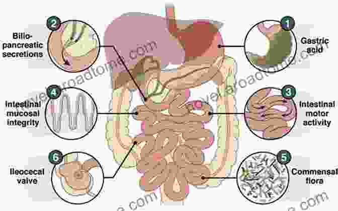 Diagram Of The Small Intestine Showing Bacterial Overgrowth SIBO DIET: The Complete Cookbook Guide For Managing (SIBO) Plus Over 50 Meal Plan