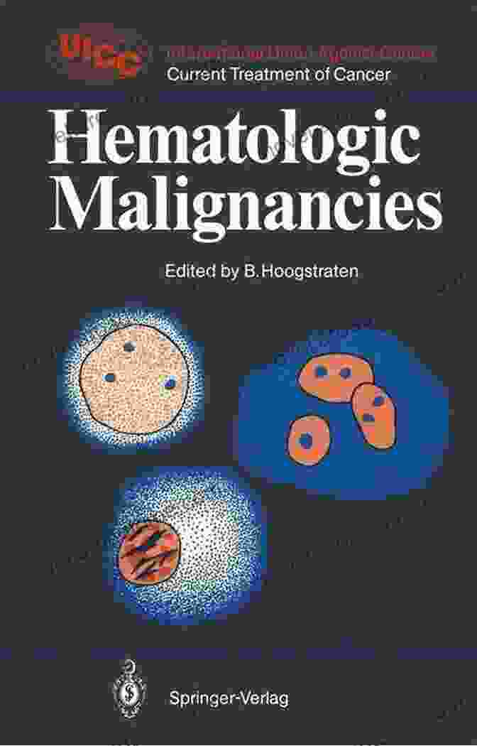 Hematologic Malignancies Uicc Current Treatment Of Cancer: A Comprehensive Guide To The Latest Advancements In Blood Cancer Treatment Hematologic Malignancies (UICC Current Treatment Of Cancer)