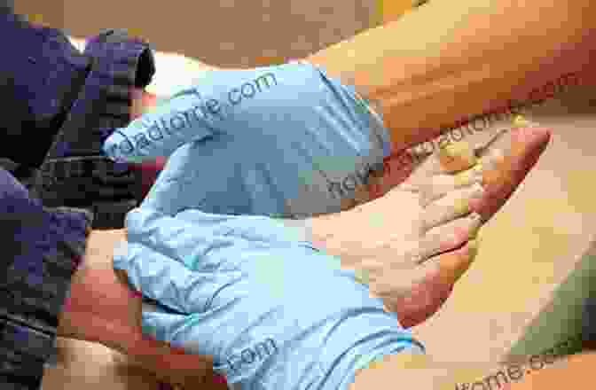 Image Of A Clinician Examining A Diabetic Foot Diabetic Foot The Randell Alexander