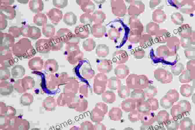 Microscopic Image Of Trypanosoma Cruzi, The Parasite That Causes Chagas Disease American Trypanosomiasis: Chagas Disease One Hundred Years Of Research (Elsevier Insights)