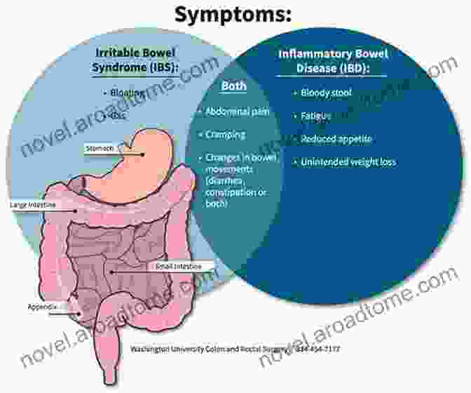 Overview Of Irritable Bowel Syndrome Irritable Bowel Syndrome : The Beginners Guide To The Treatment Of Irritable Bowel Syndrome