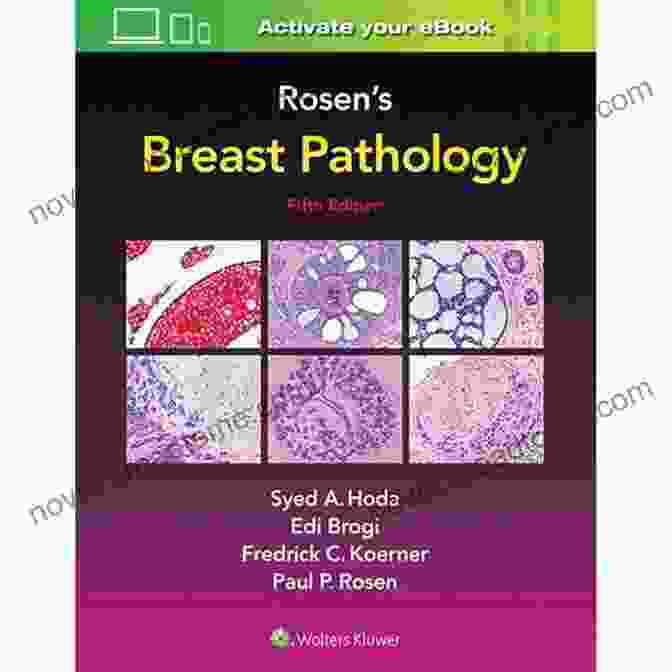 Rosen Breast Pathology By Syed Hoda Rosen S Breast Pathology Syed A Hoda