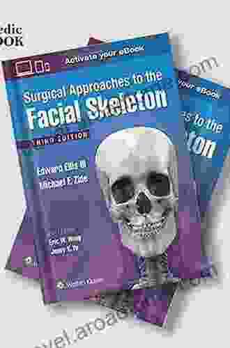 The Art Of Aesthetic Surgery: Facial Surgery Volume 2 Third Edition: Principles And Techniques