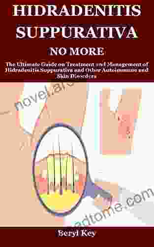 HIDRADENITIS SUPPURATIVA NO MORE: The Ultimate Guide on Treatment and Management of Hidradenitis Suppurativa and Other Autoimmune and Skin Disorders