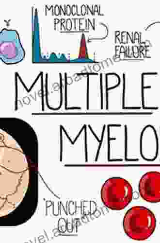 Understanding Multiple Myeloma Robert Kopf